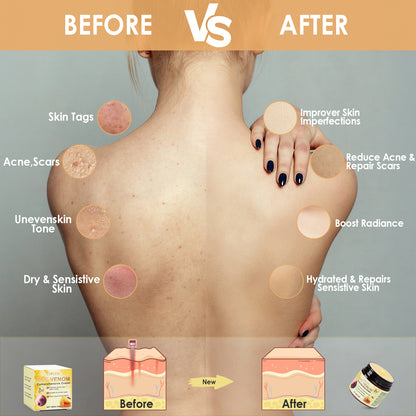 Bee Venom Hydrating Skin Care Cream